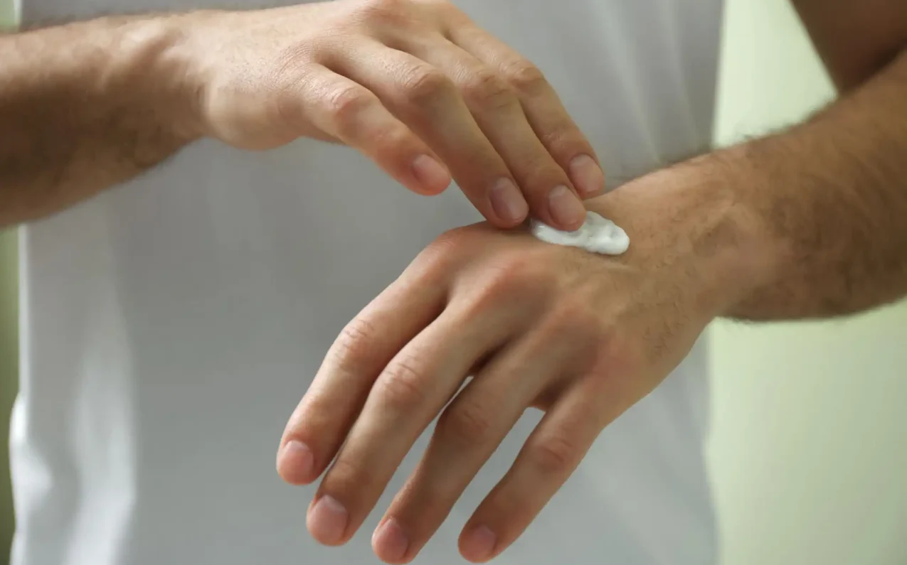 Regular eczema cream use